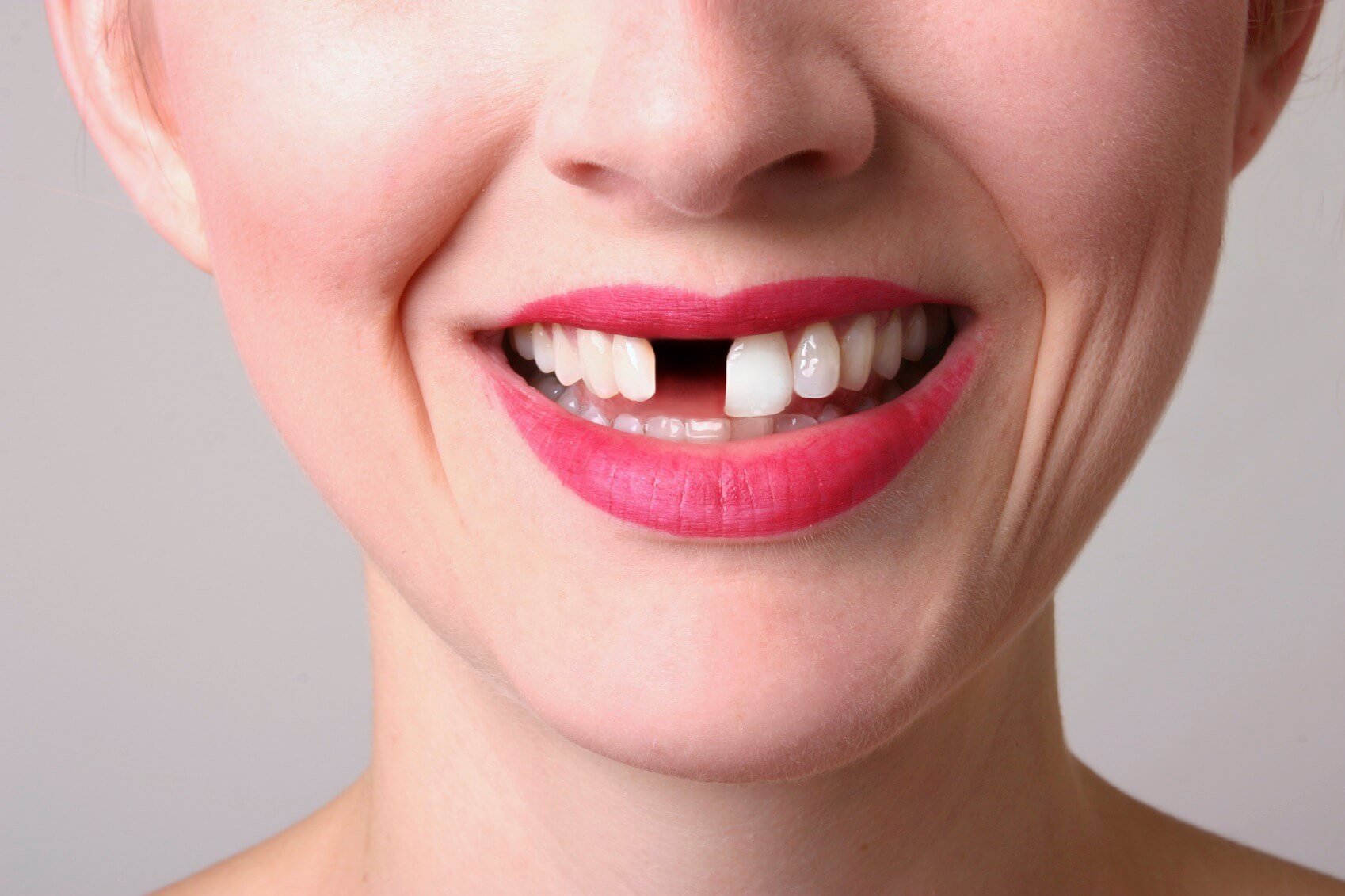 Как решить и предотвратить актуальные проблемы с зубами